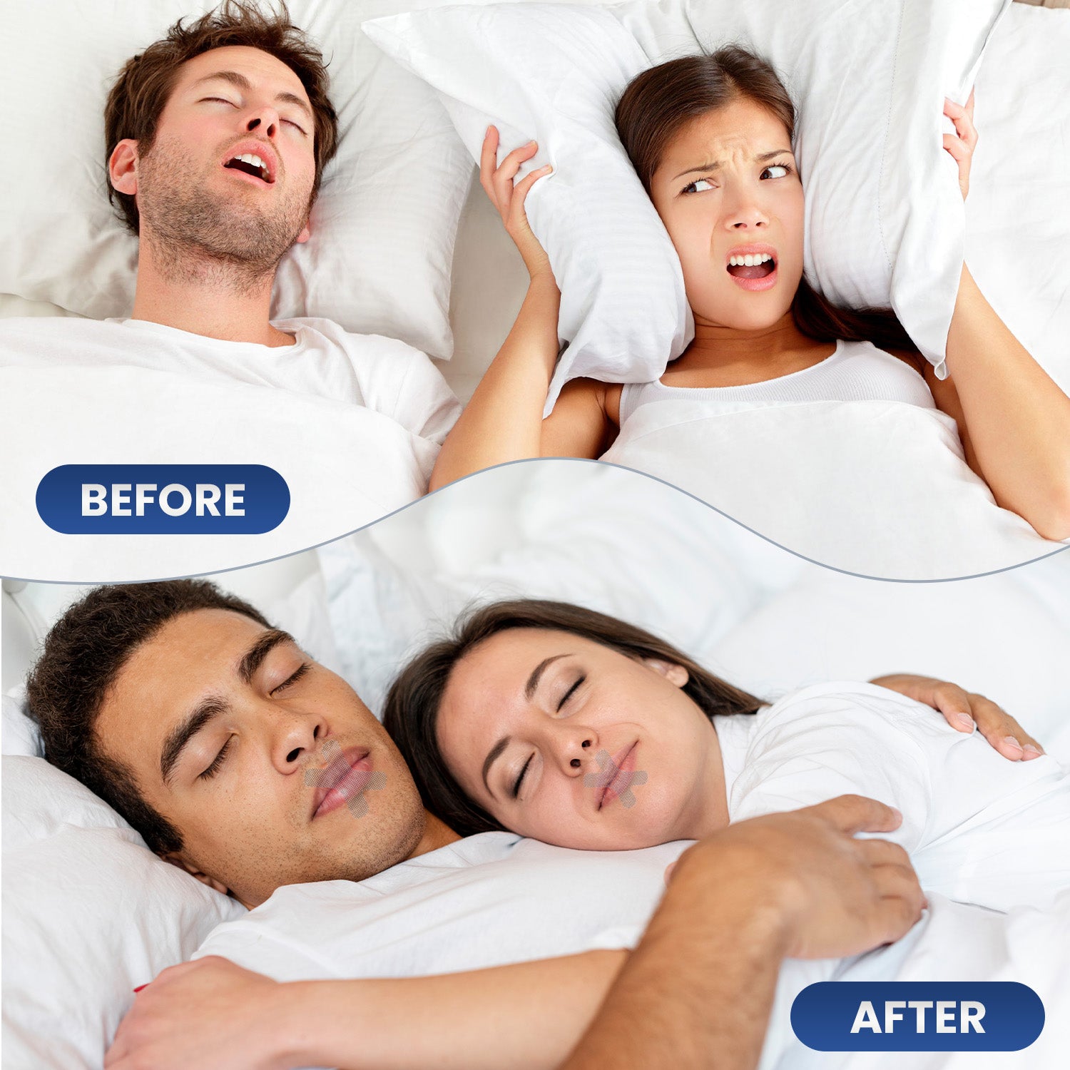 OhmRx Mouth Tape – X Clear | Gentle, Hypoallergenic Nighttime Breathing Strips (90 Count)