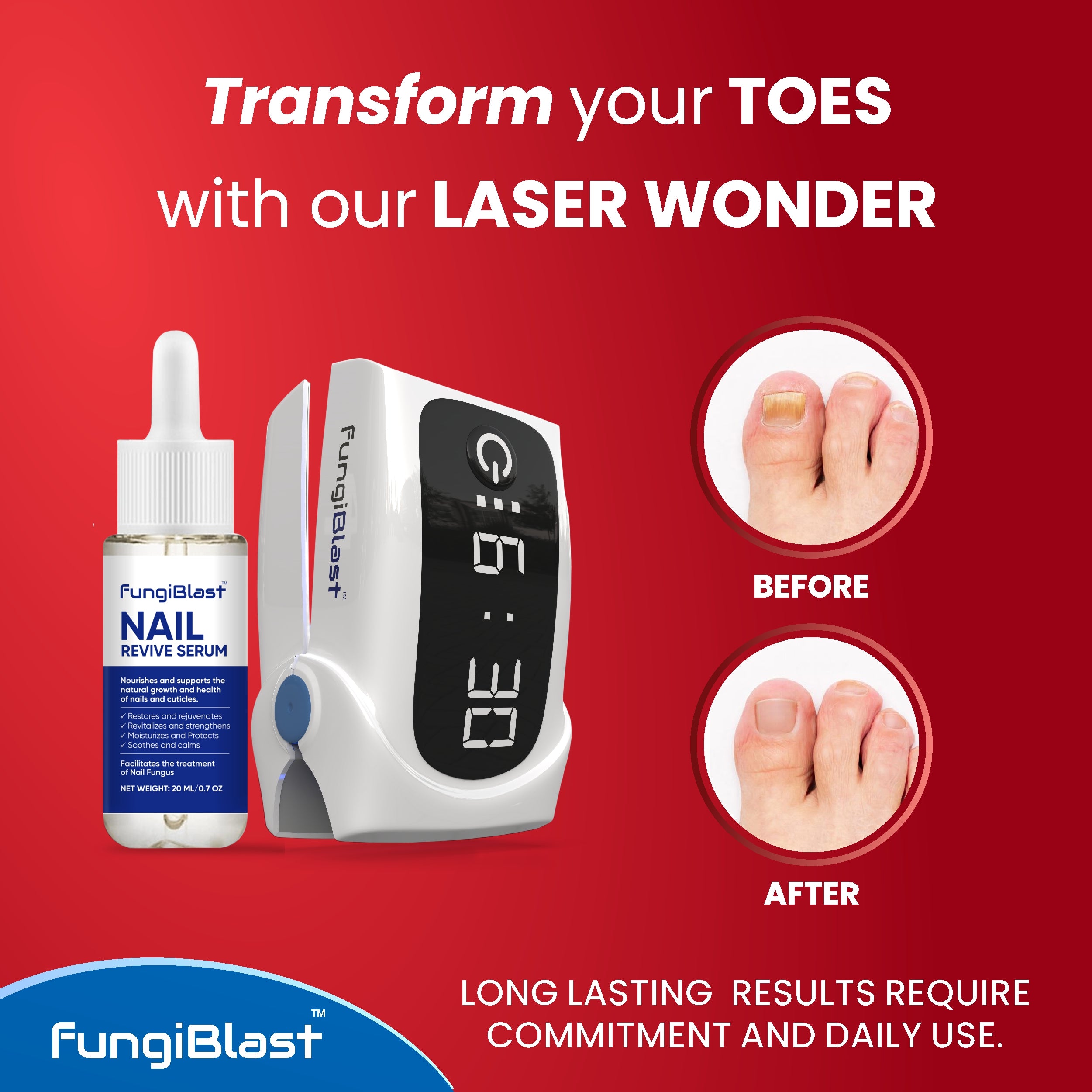 FungiBlast 21 Nail Fungus Laser Treatment Device & Serum Effective